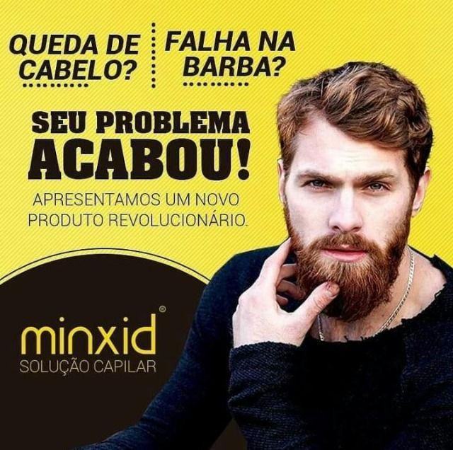 Minoxidil 15% o melhor do mercado - Foto 2