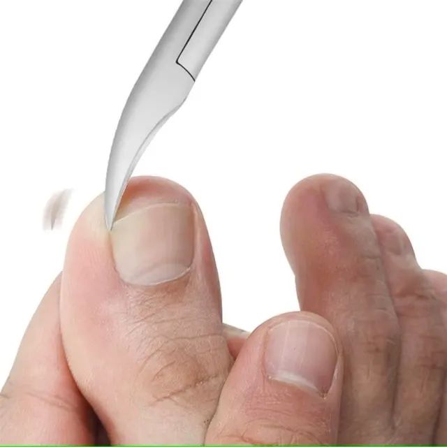 Alicate Curvo Para Unha Encravada Aço inoxidável Resistente - Foto 2