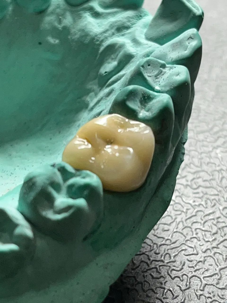 Seu melhor sorriso é  a melhor prótese  - Foto 2