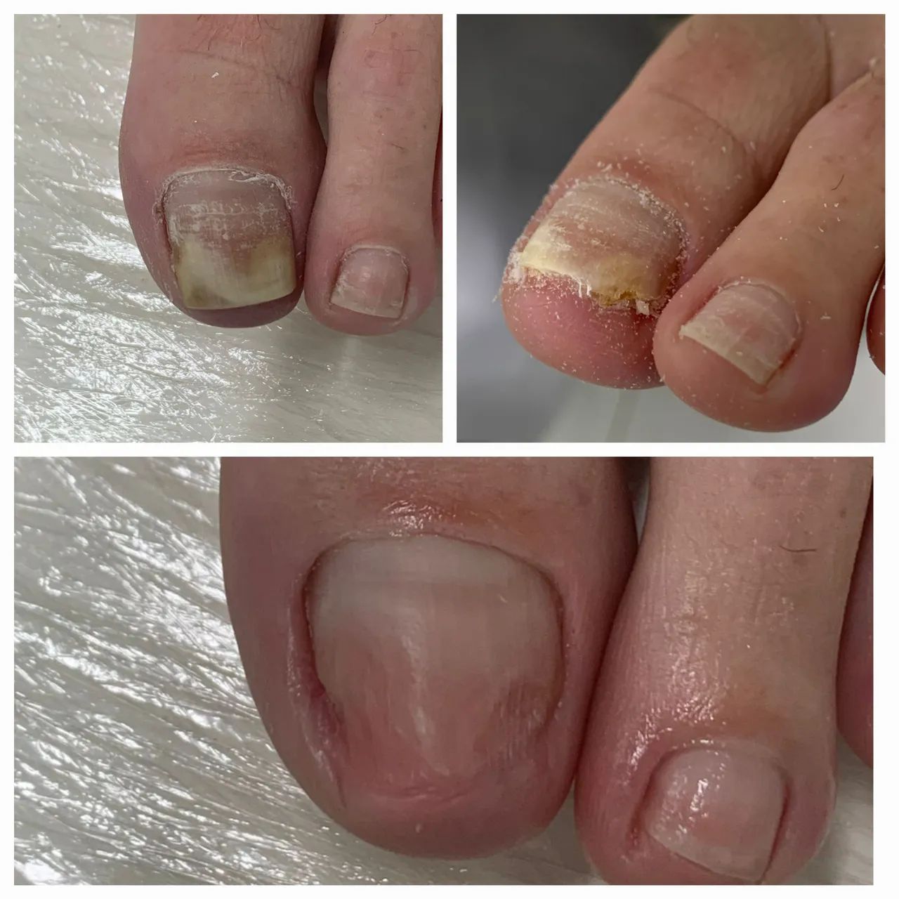 Manicure a domicílio  - Foto 2