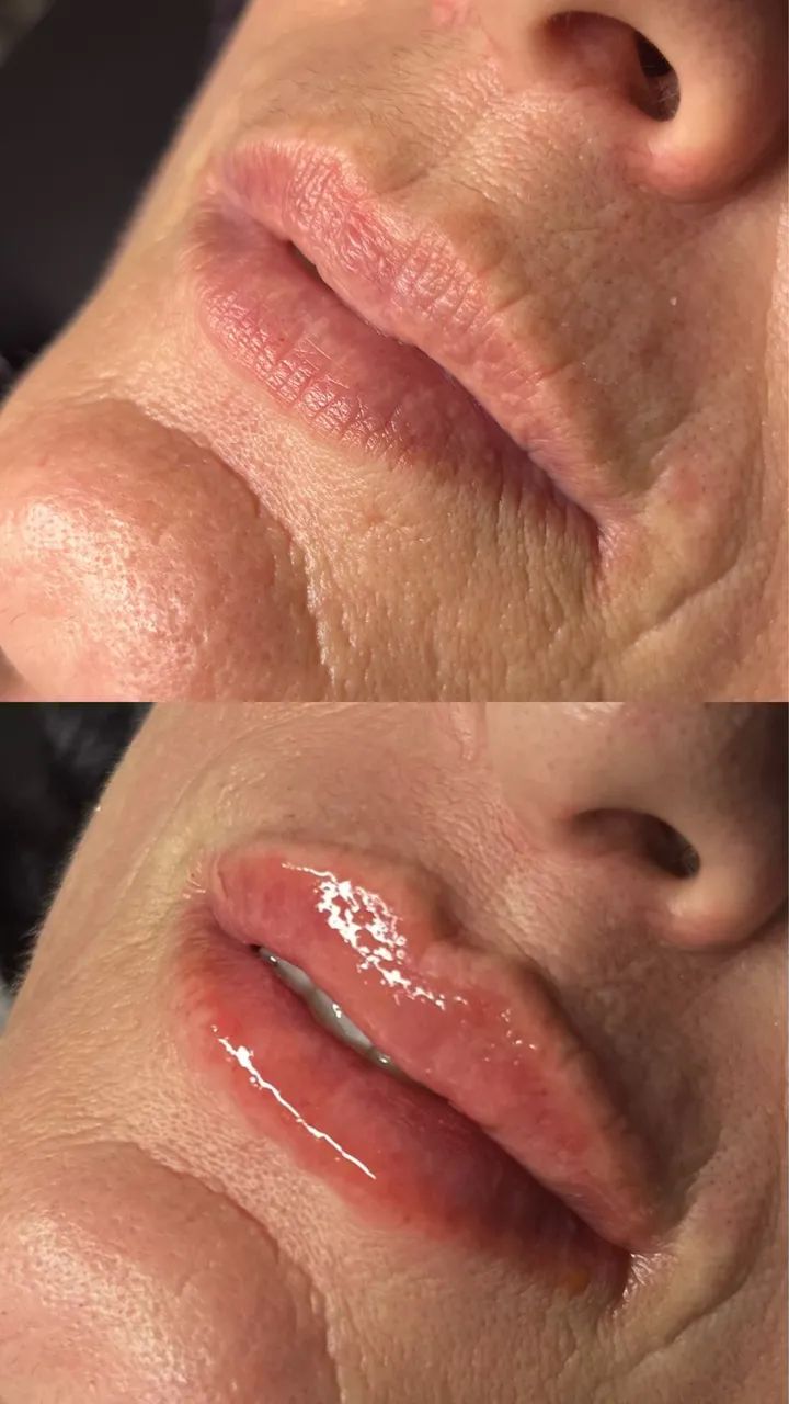 MICROPIGMENTAÇÃO LABIAL - Foto 2
