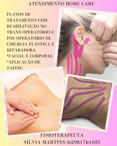 Pós operatório de cirurgia plástica corporal e Facial  - Foto 2