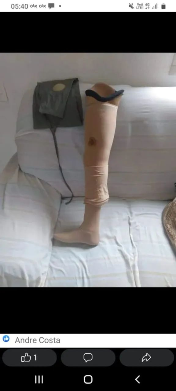 Venda de Prótese  - Foto 2