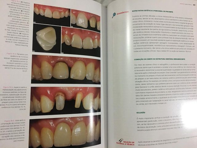 Livro de Destítica do autor Ewerton Nocci - odontologia - Foto 4