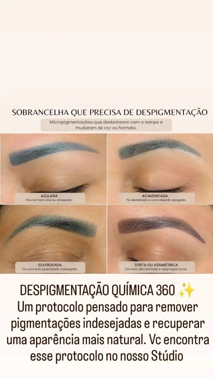 Despigmentação de sobrancelhas  - Foto 2