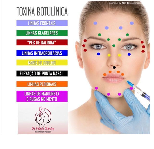 Botox (Toxina botulínica)