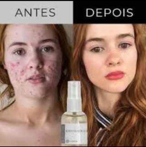 Acido Glicolico Hinode  - Foto 4