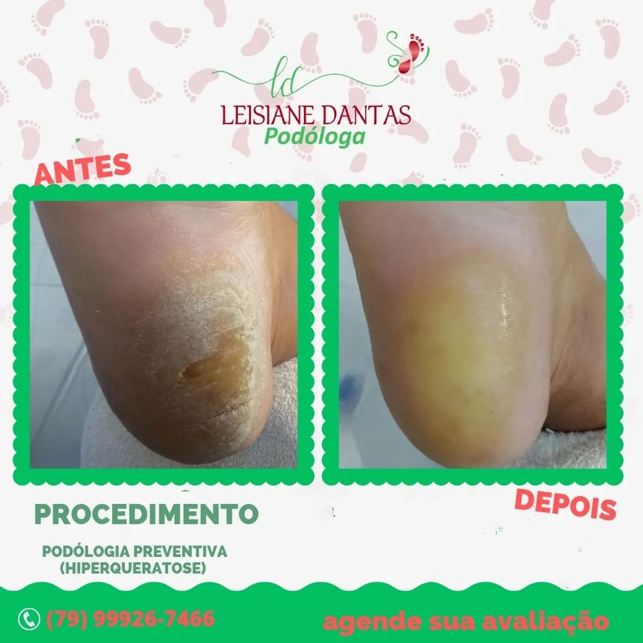 Cuidados com os pés?  ?  ? - Foto 2