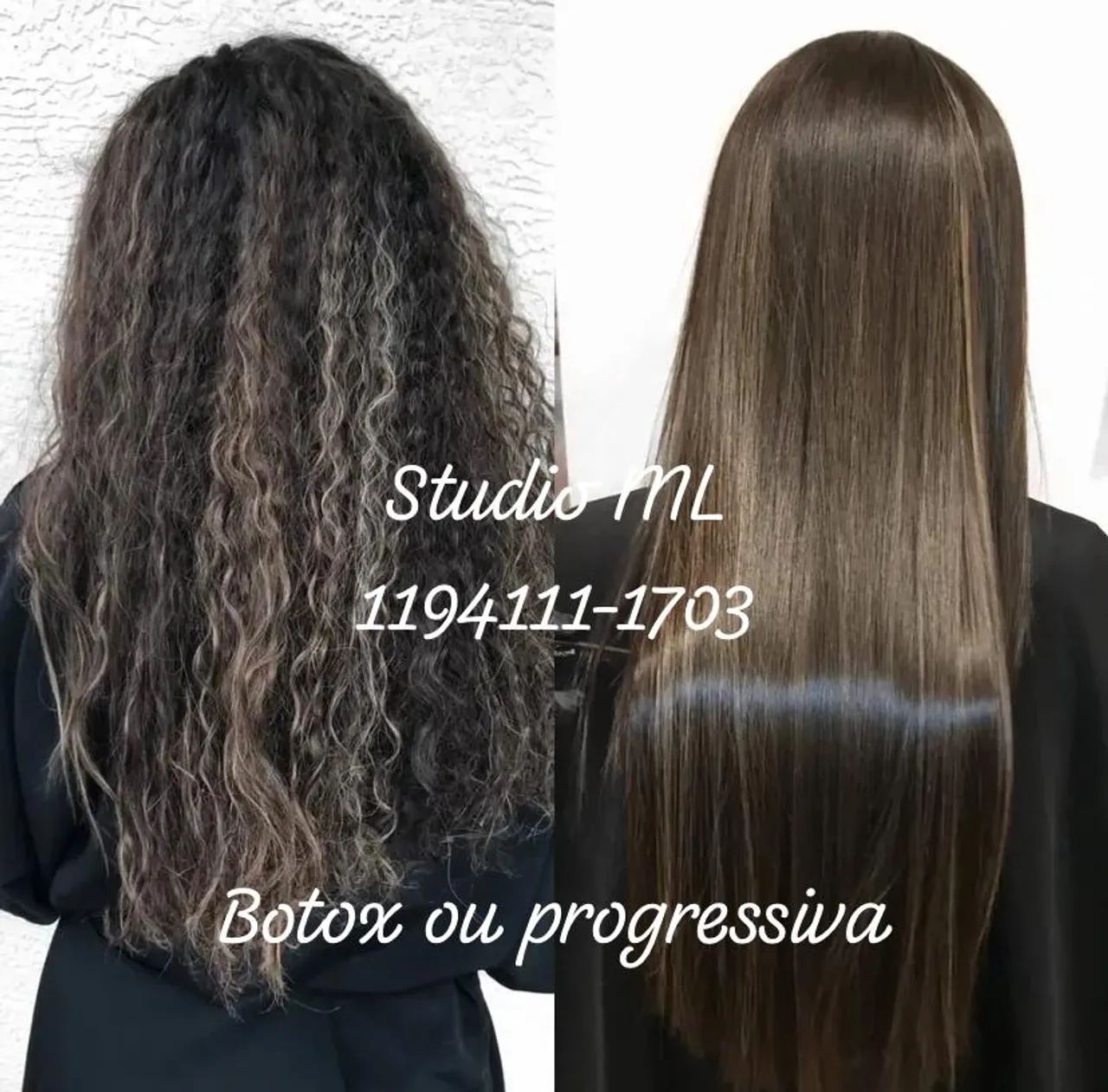 Progressiva ou botox