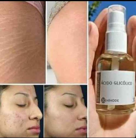 Acido Glicolico Hinode  - Foto 5