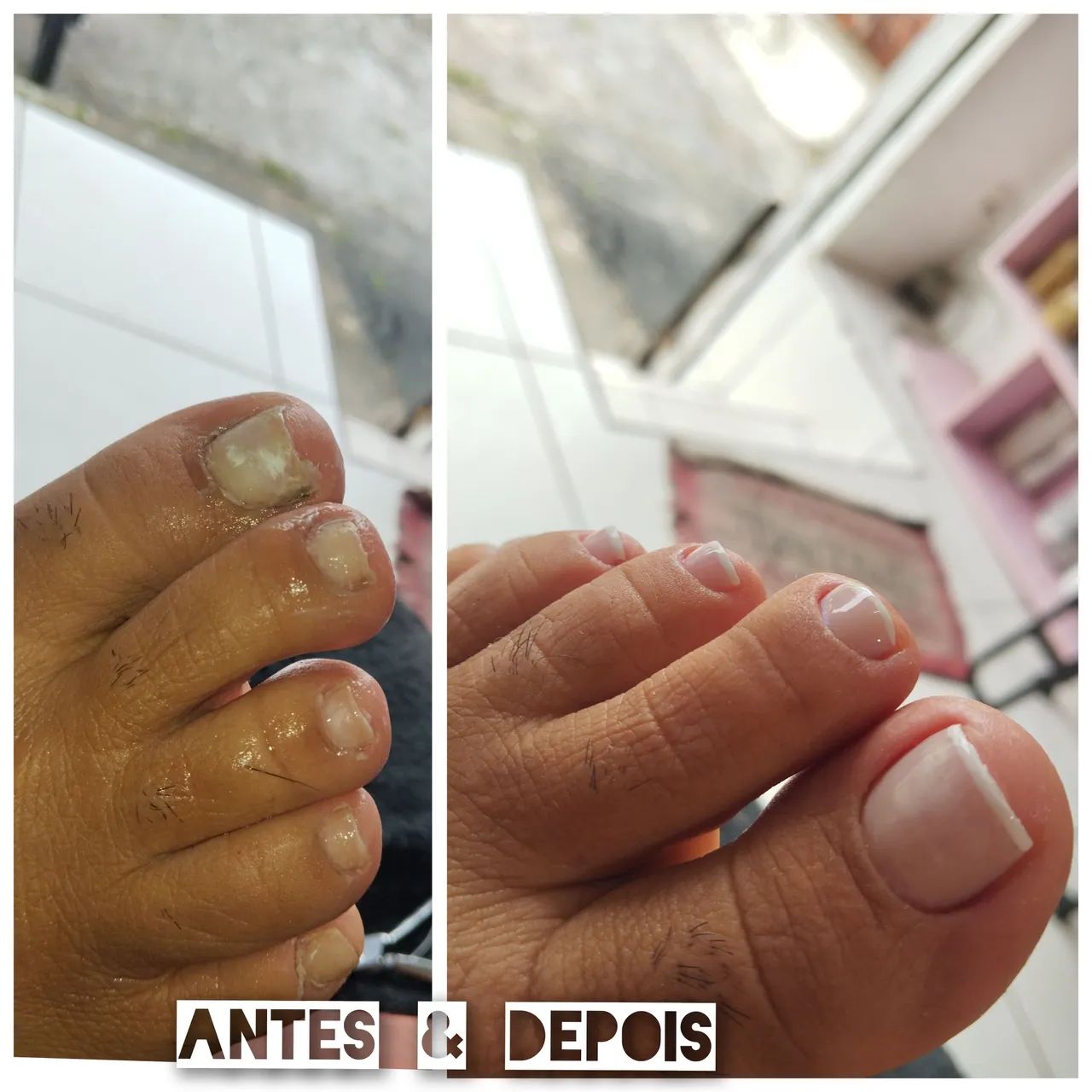 Unhas & cabelos, - Foto 5
