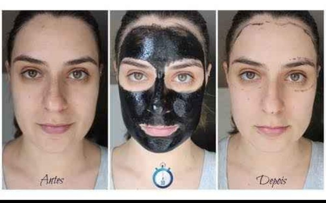 Máscara facial para Remover cravos  - Foto 3