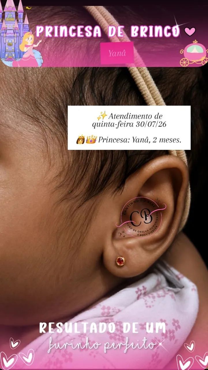 Furo de Orelha Humanizado - Foto 4