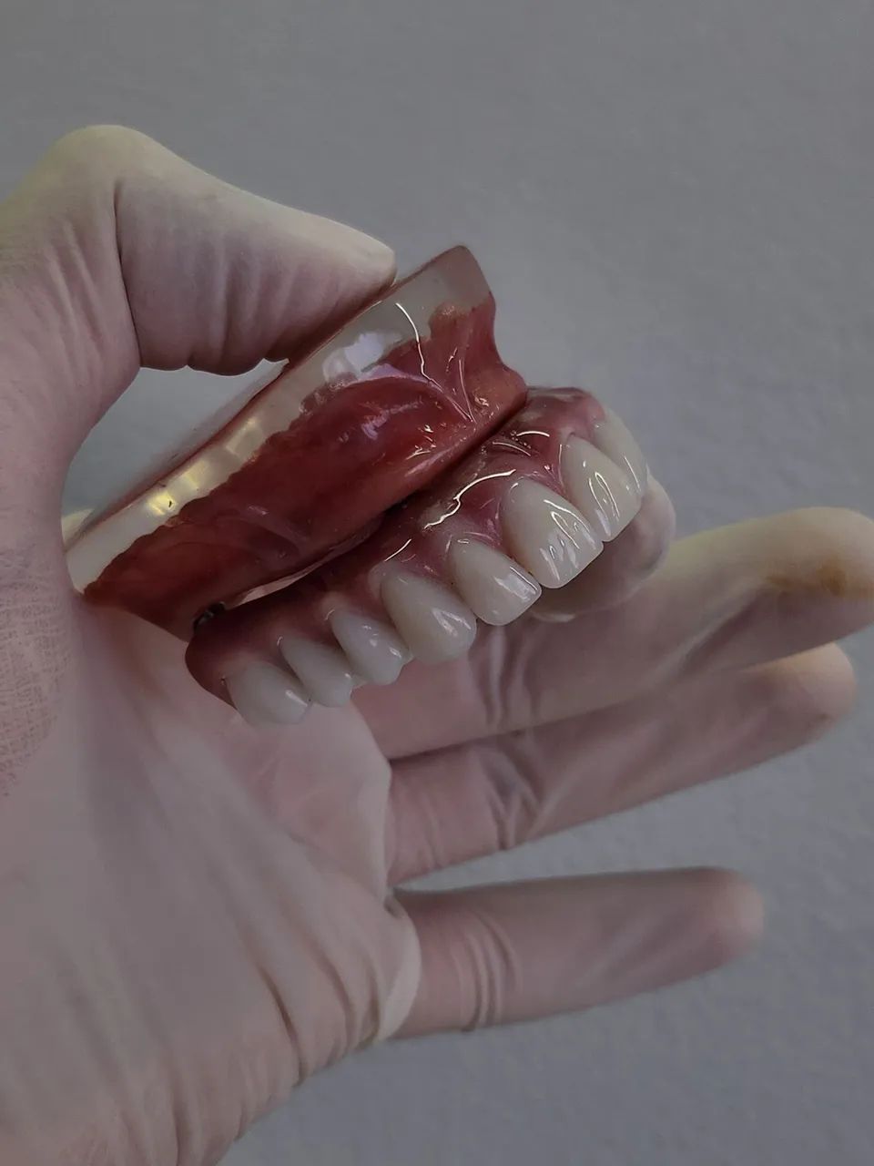 Confecção de dentaduras e proteses com grampo - Foto 3