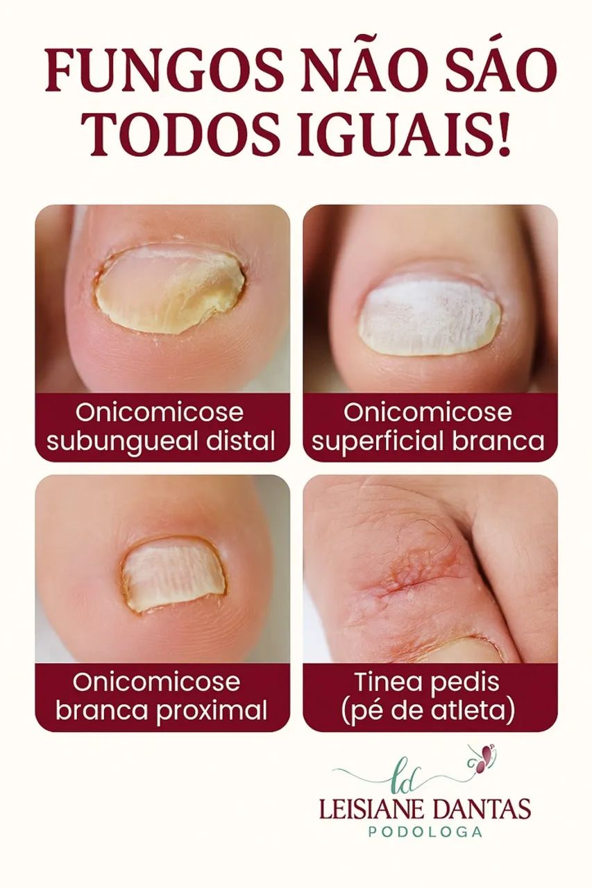 Julho com cuidados para seus pés! - Foto 3