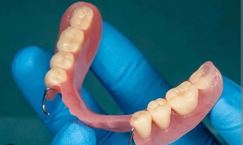 Protético Proteses Flexivel Fixa Implantes - Zona Oeste e Região - Foto 3