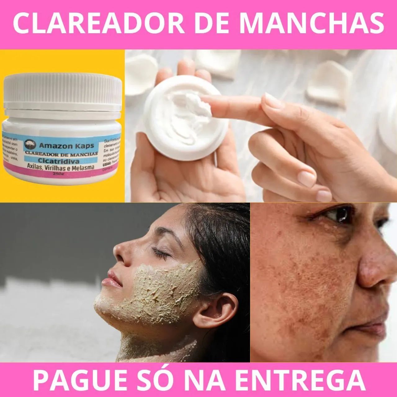 Clareador de Manchas | Pague Só na Entrega | Resultado Garantido!