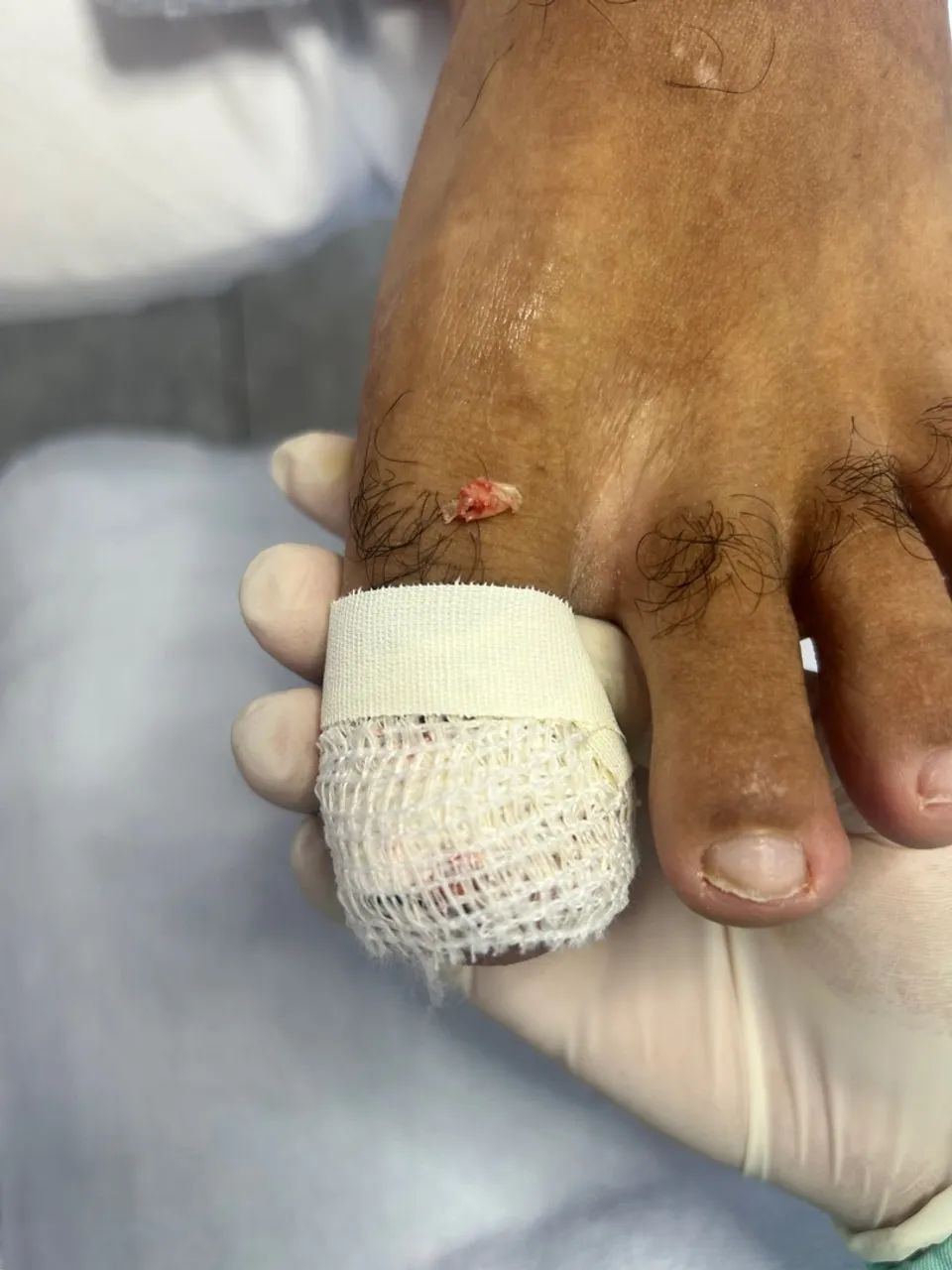 Julho com cuidados para seus pés! - Foto 4