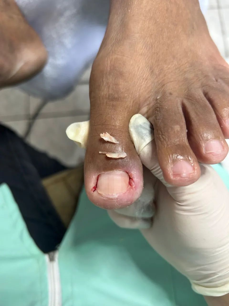 Julho com cuidados para seus pés! - Foto 5