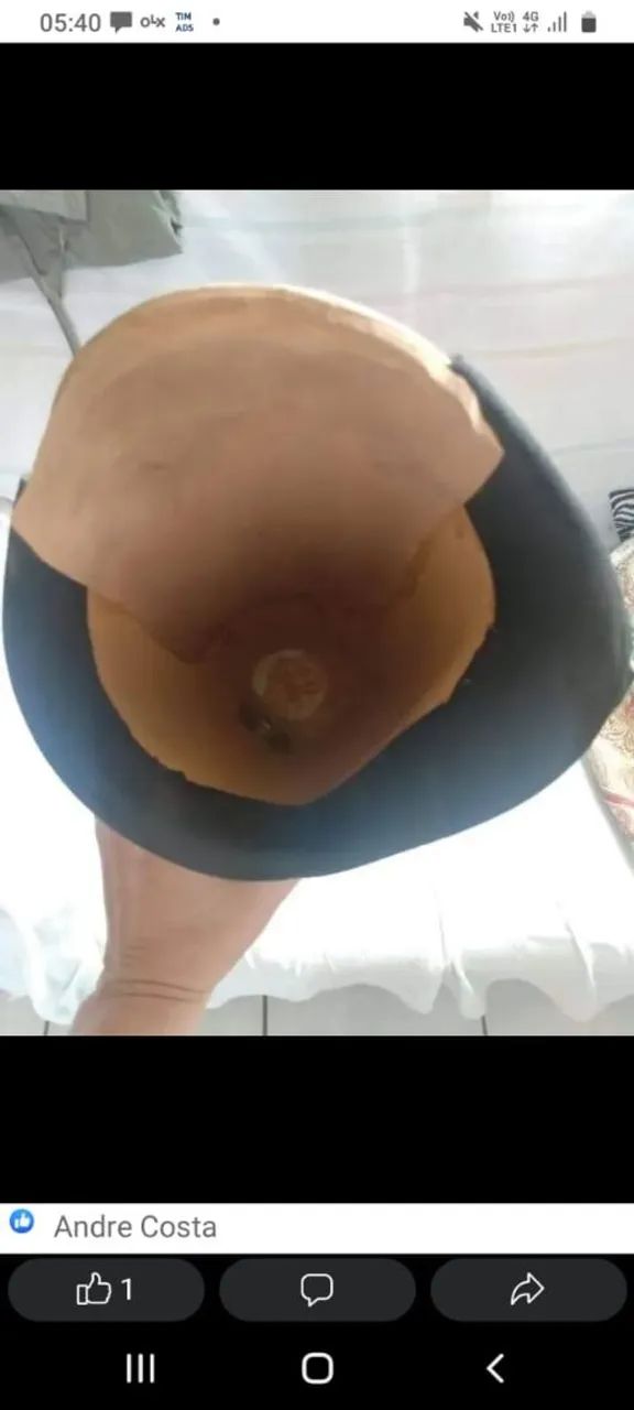 Venda de Prótese  - Foto 3