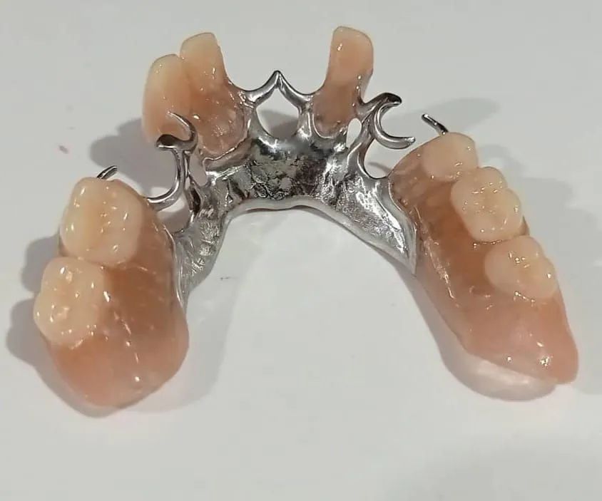 Próteses Dentarias - Foto 2