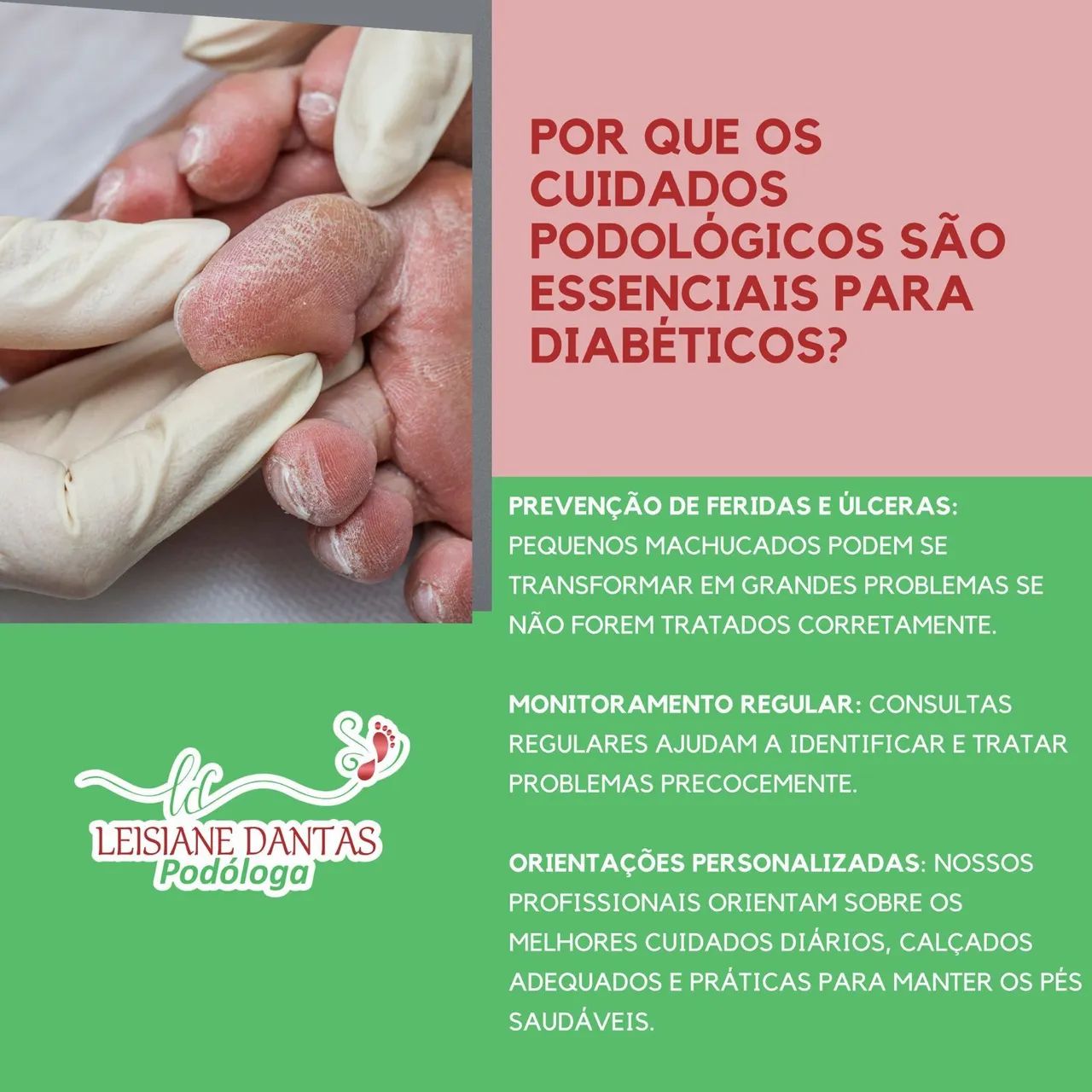 Cuidados com os pés?  ?  ? - Foto 4