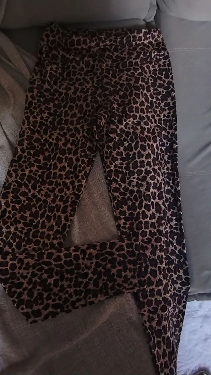 Legs