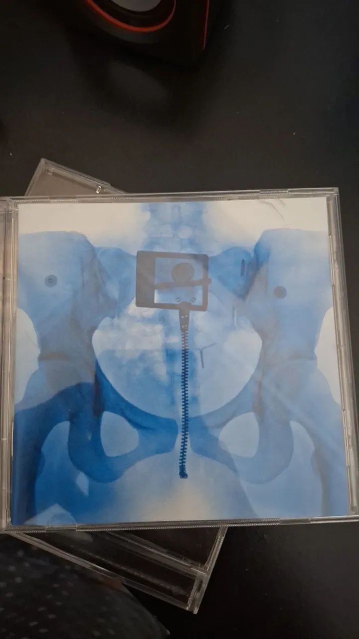 CD internacional - Foto 2