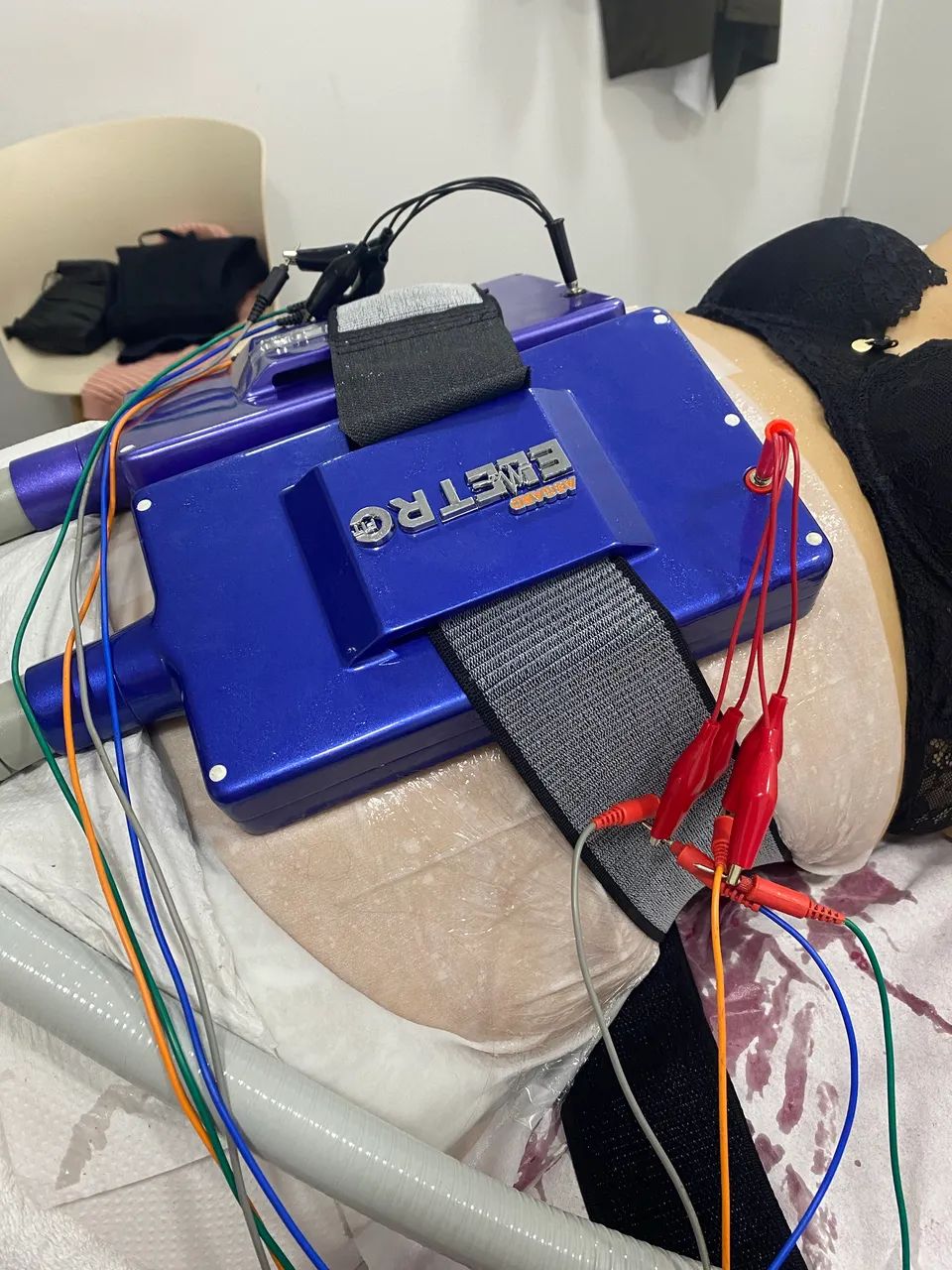 Criolipolise Asgard VC9 Adoxy - Foto 2