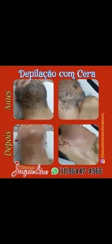 Depilação  homens e mulheres  - Foto 3