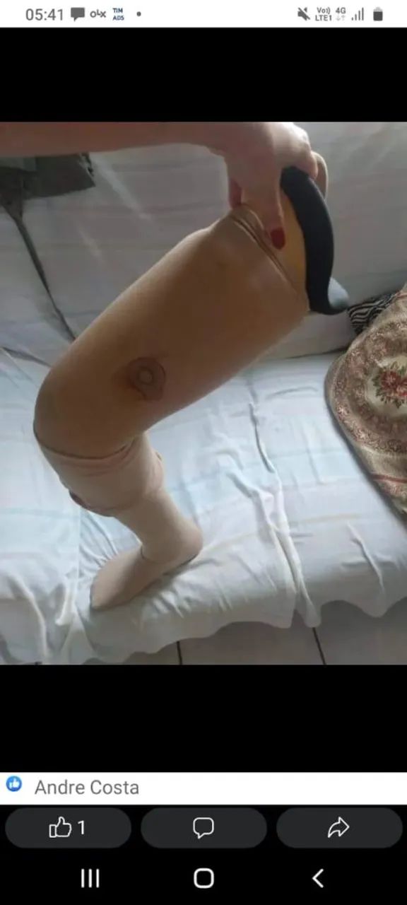 Venda de Prótese  - Foto 5