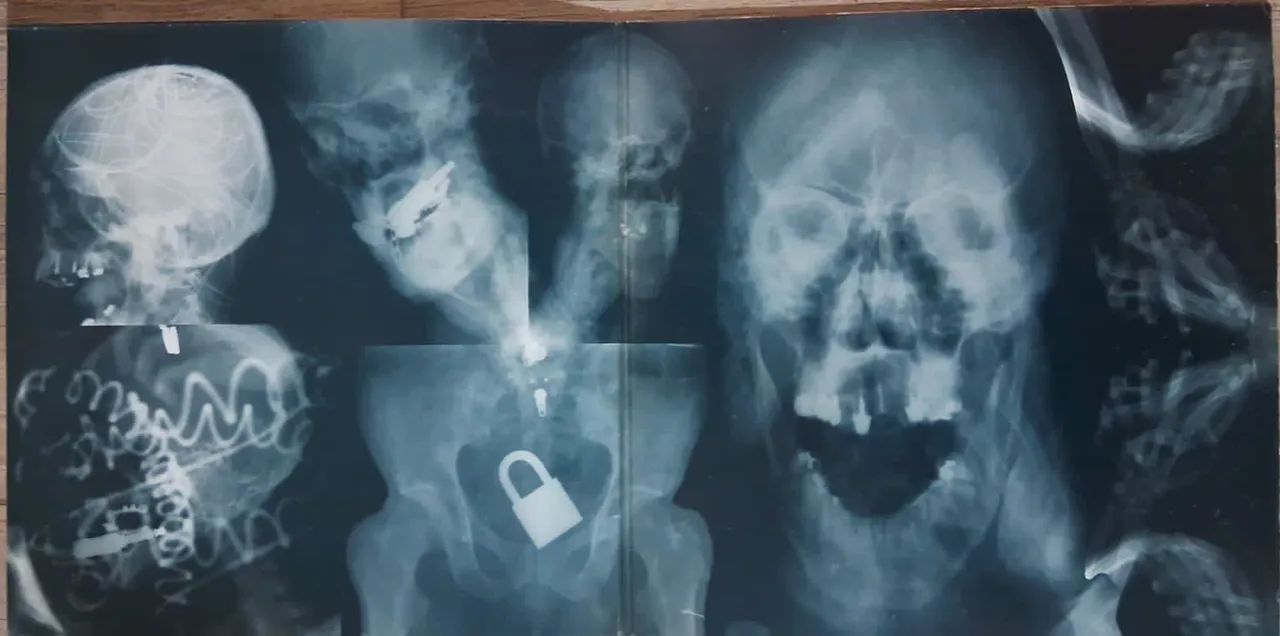 Vendo disco de vinil Titãs - Foto 3