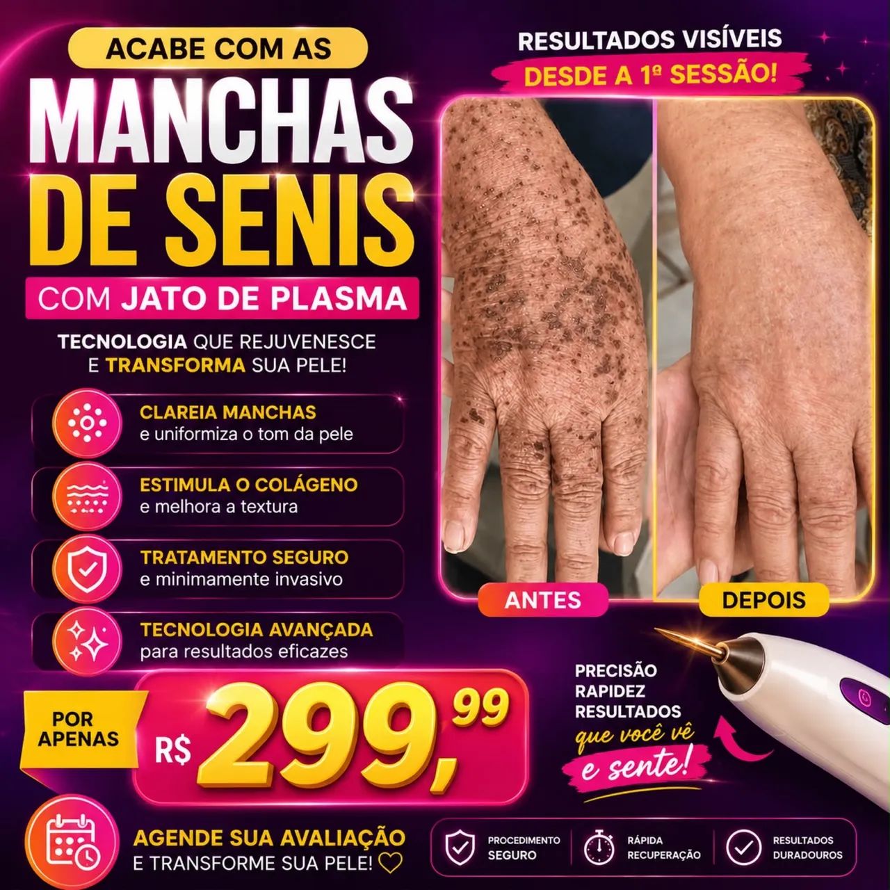 Pele sem manchas? 