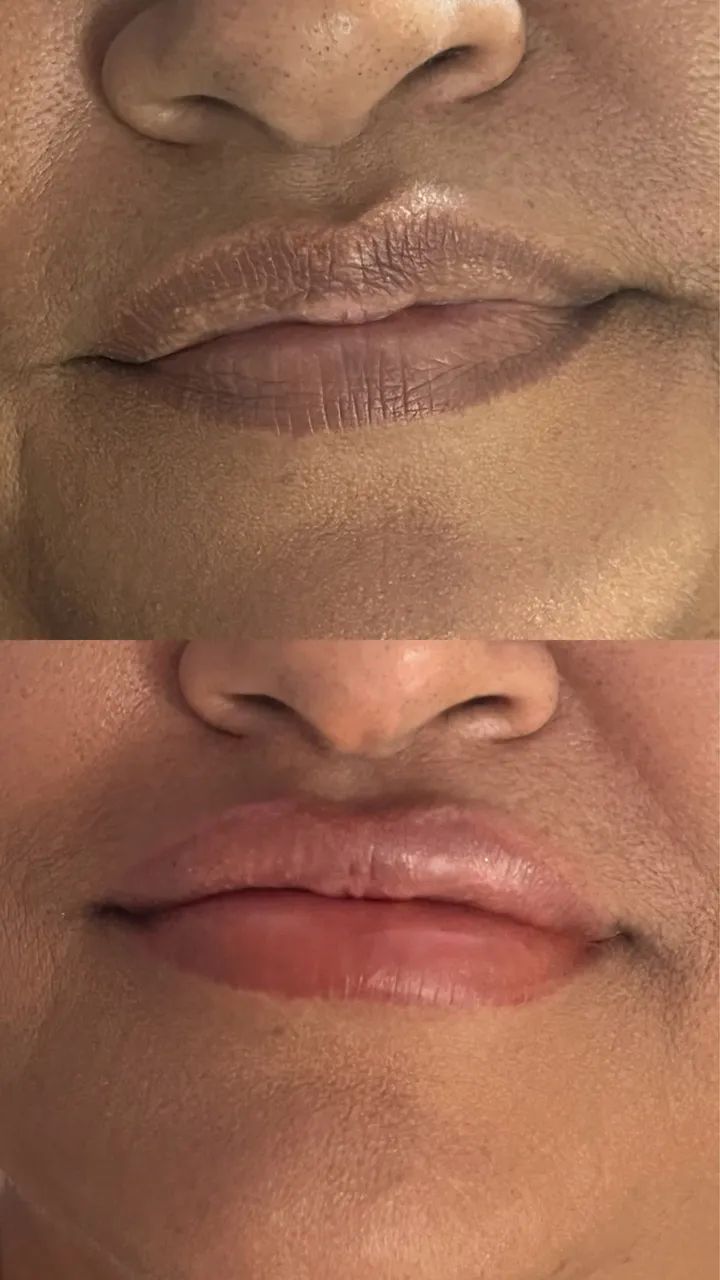 MICROPIGMENTAÇÃO LABIAL - Foto 4