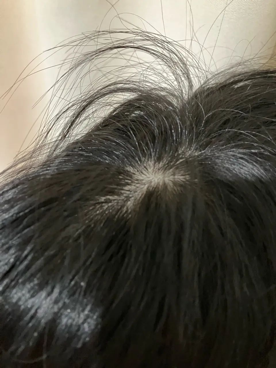 Prótese capilar original novo  - Foto 3
