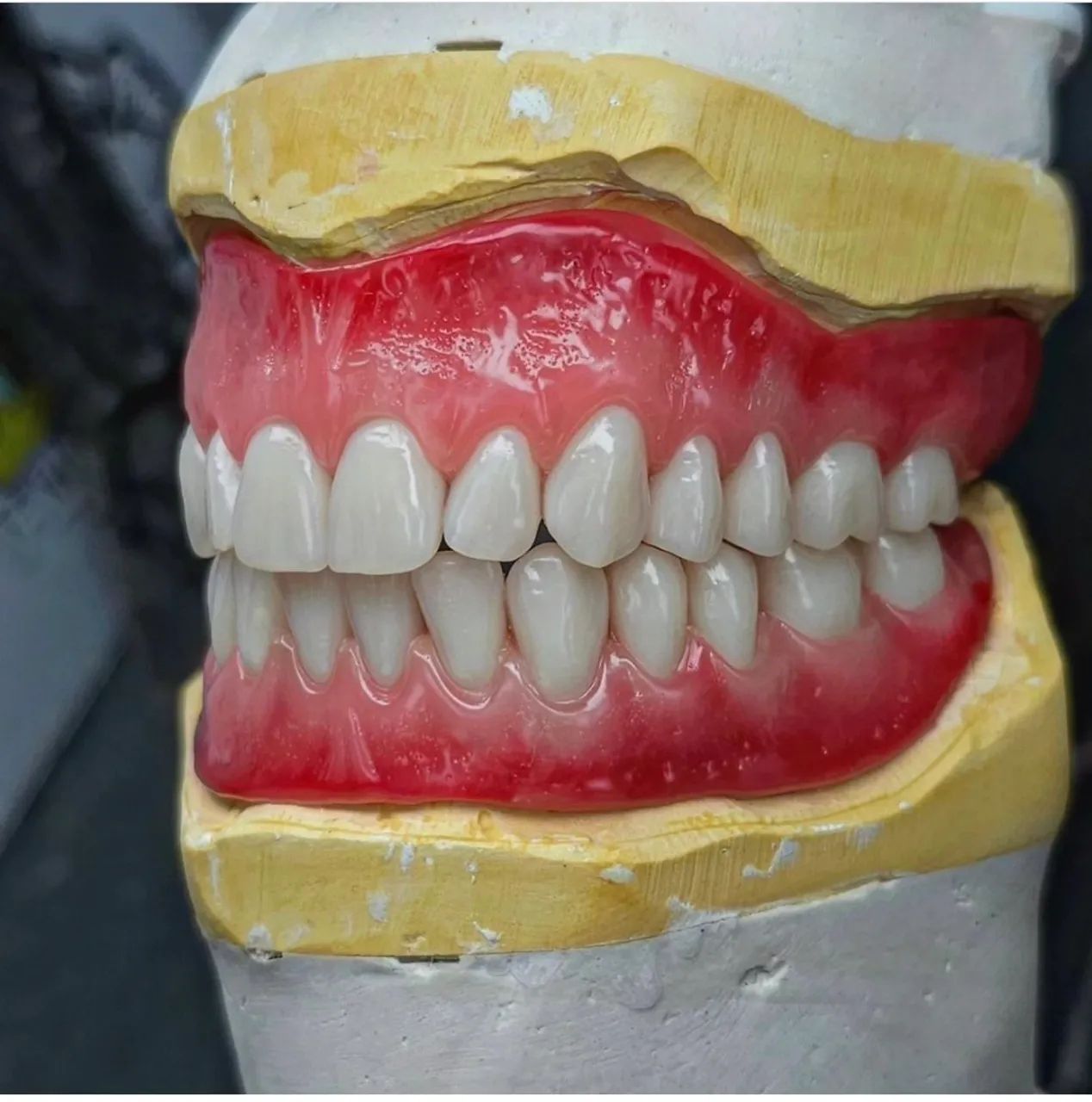 Seu melhor sorriso é  a melhor prótese  - Foto 5