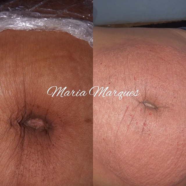 Jato de plasma - Foto 4