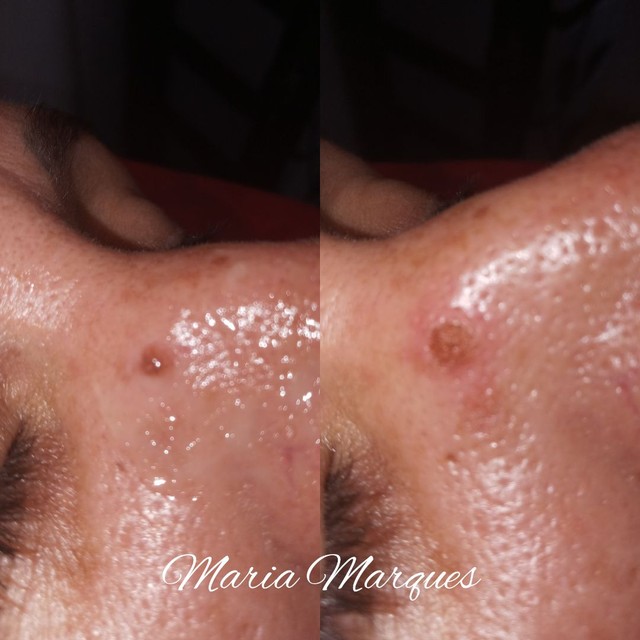 Jato de plasma - Foto 5