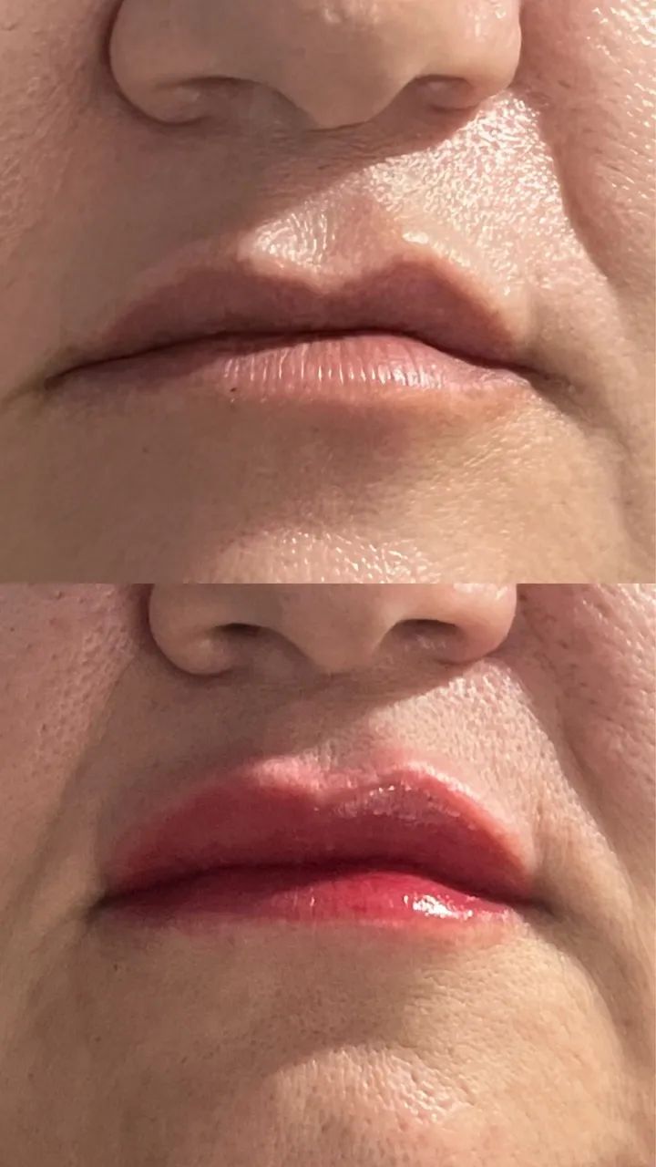MICROPIGMENTAÇÃO LABIAL - Foto 5