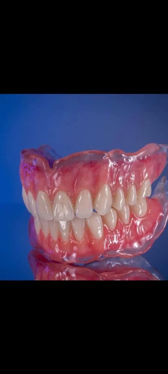 Dente Prótese Dentária 