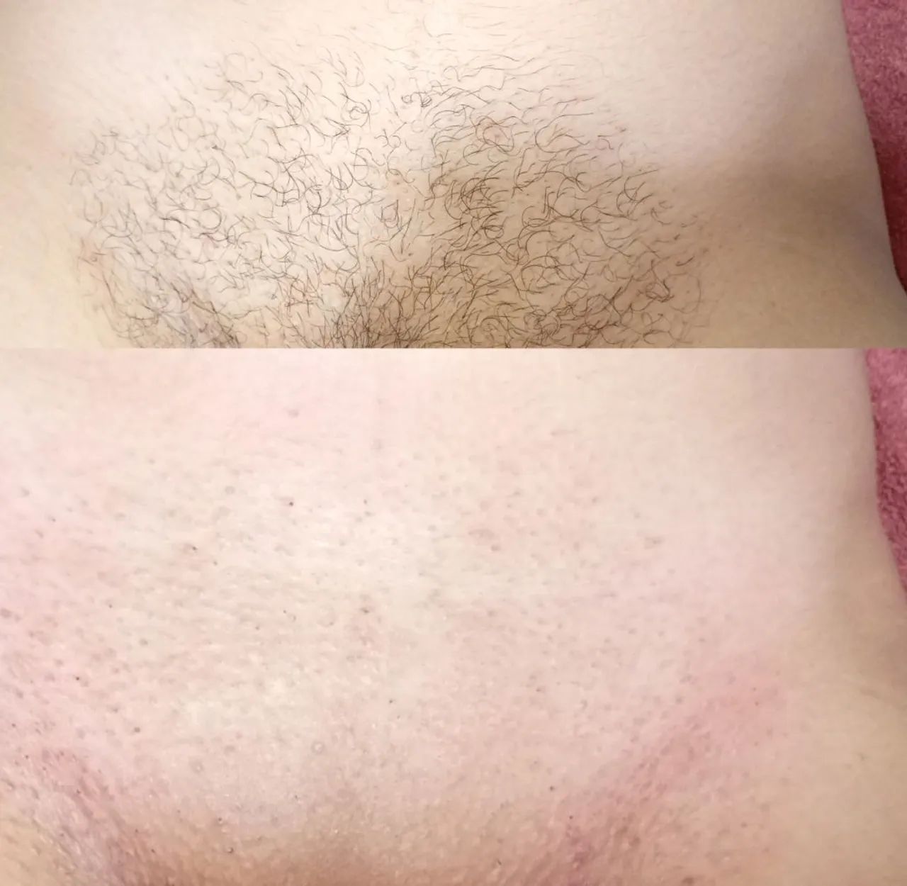 DEPILAÇÃO COM CERA EM DOMICÍLIO  - Foto 2
