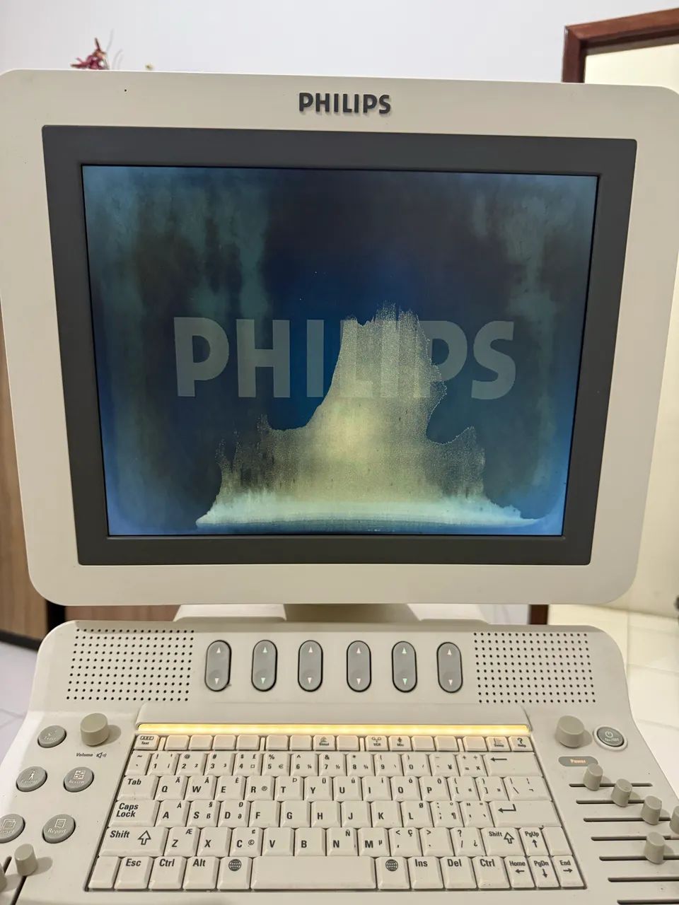 Aparelho USG- HD7 - Foto 4