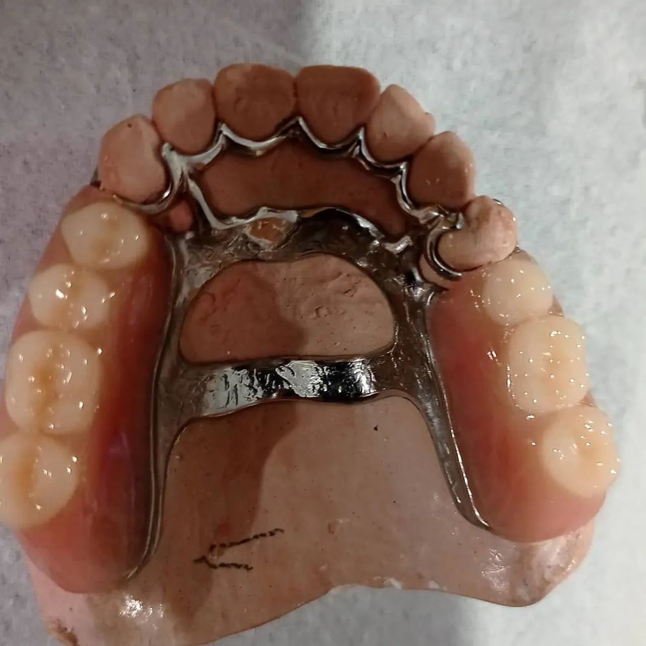 Próteses Dentarias - Foto 4
