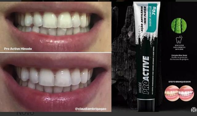 Gel Dental