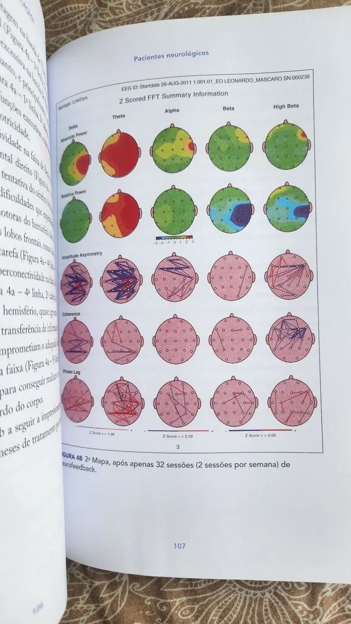 Pra que meditação? - Foto 3