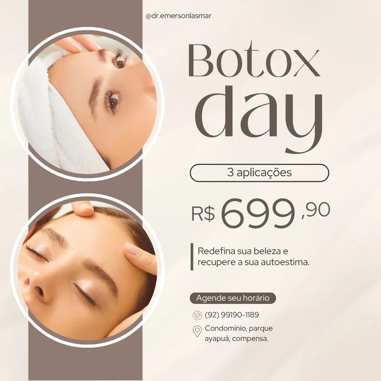 Botox day