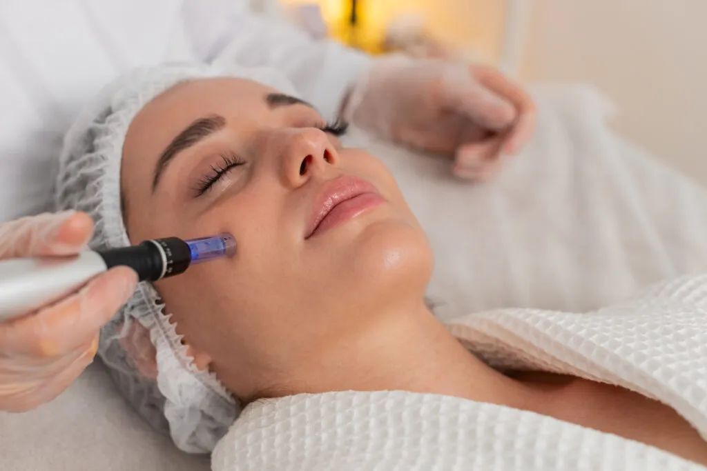 Microagulhamento facial 