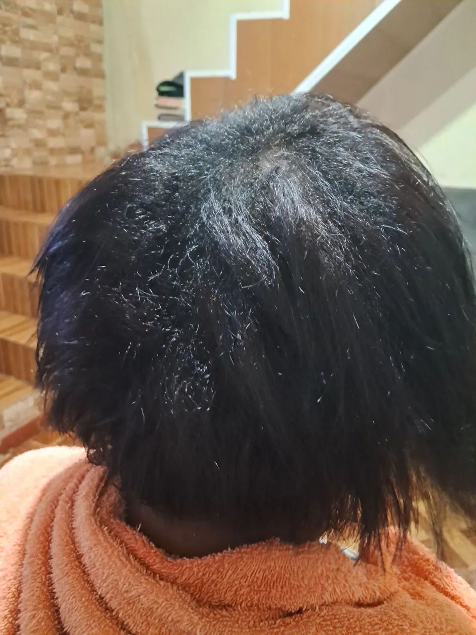 Escova Redutora  - Foto 2