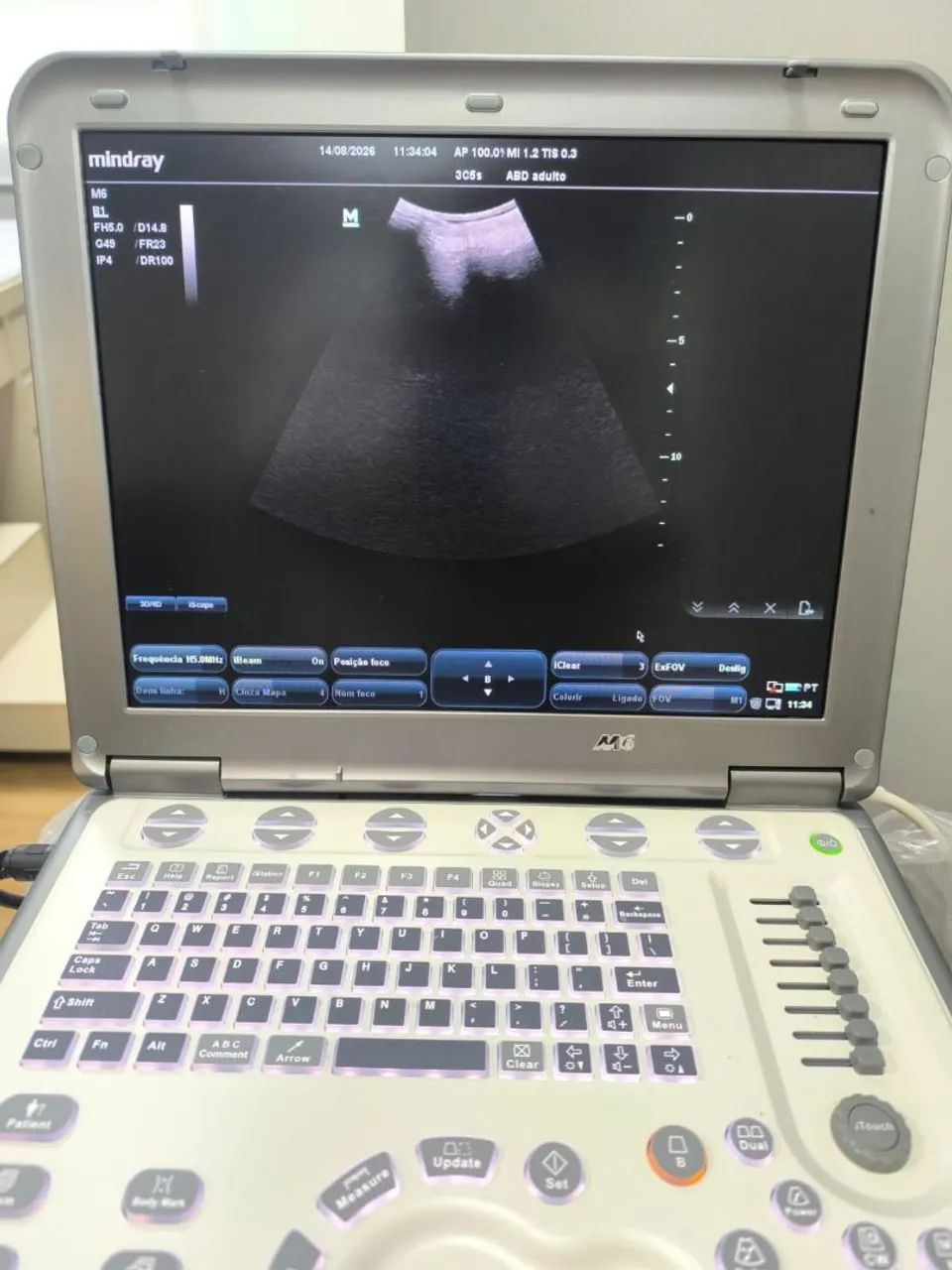 Equipamento de ultrassom Mindray M6  - Foto 4