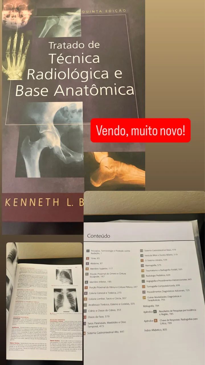 Treatise on Radiological Techniques